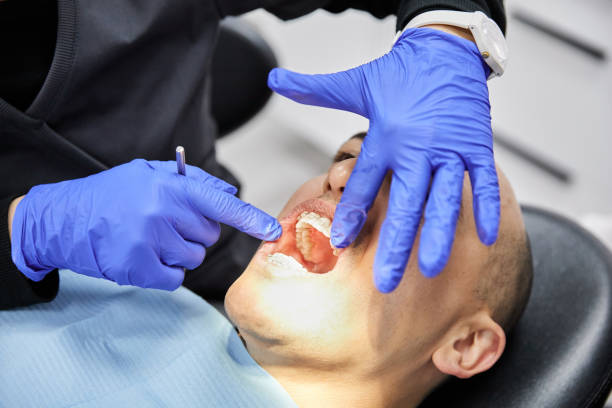 Best Emergency Dentist for Knocked-Out Tooth in Kenton, TN